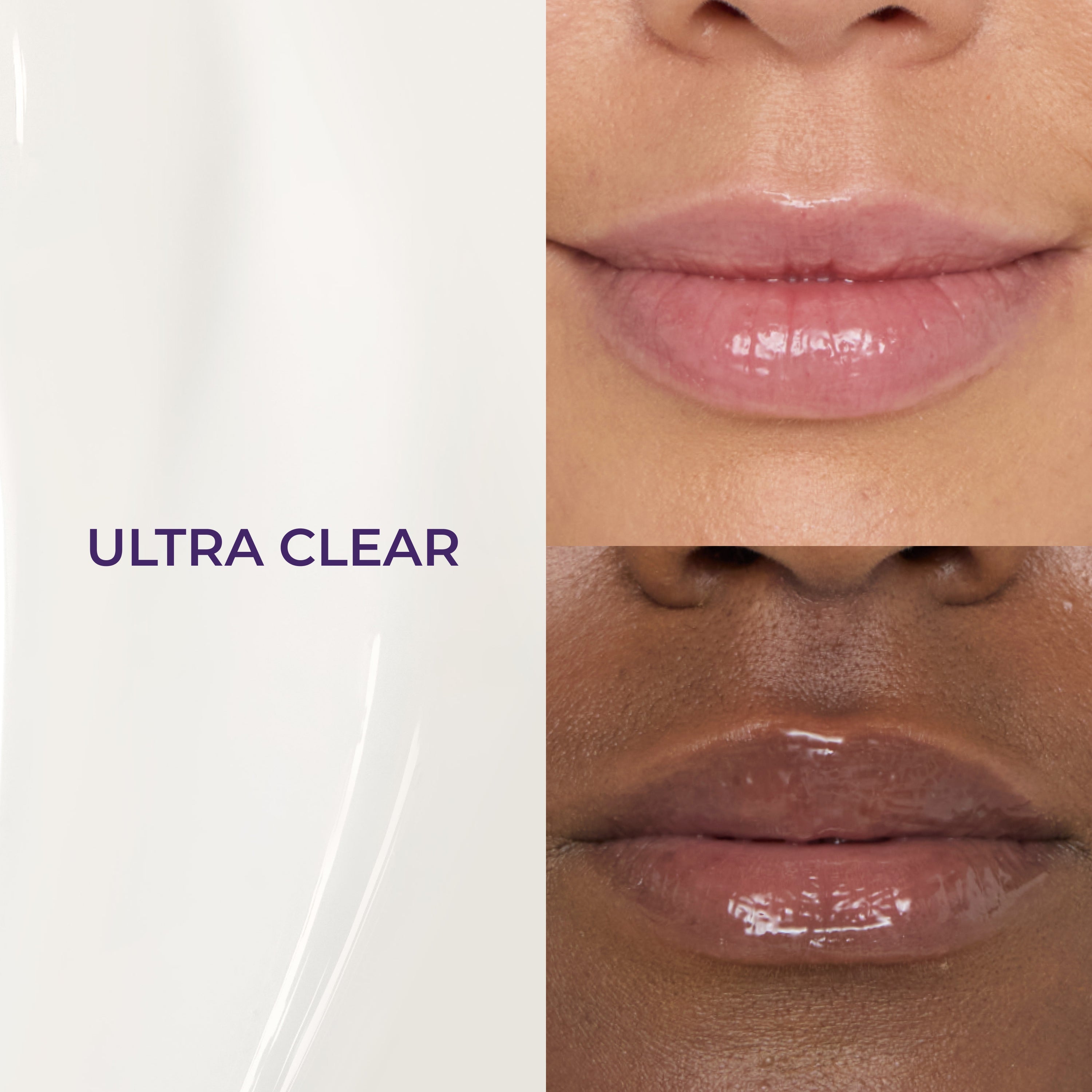 Perfect Pout Set